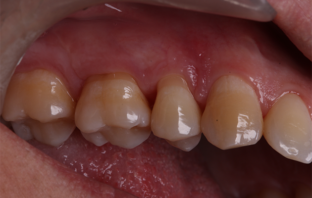 22 | Acompanhamento 90 dias.