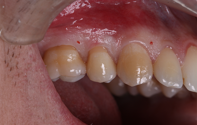 5 | Condição clínica pré-cirúrgica.