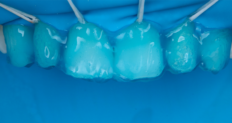 Passo 1 - Kit Estética