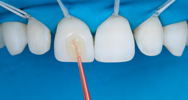 Passo 2 - Kit Estética