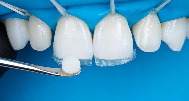 Passo 3 - Kit Estética