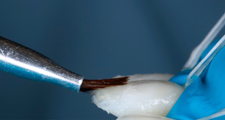 Passo 4 - Kit Estética