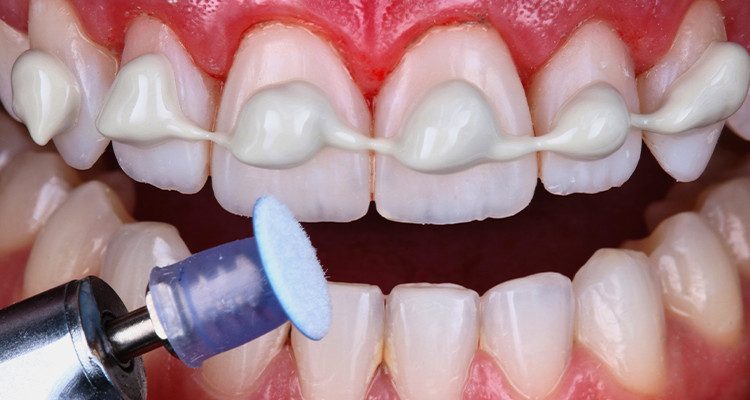 Passo 5 - Kit Estética