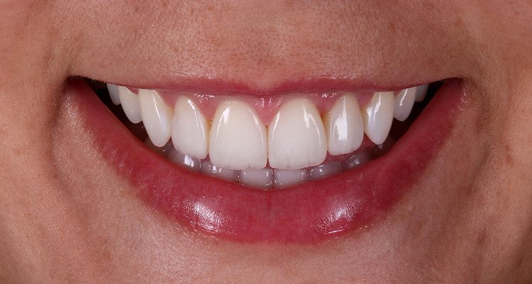 Passo 6 - Kit Estética