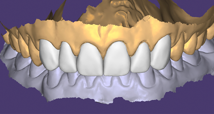 2 | Planejamento digital do sorriso.