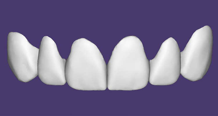 4 | Facetas prontas para impressão.