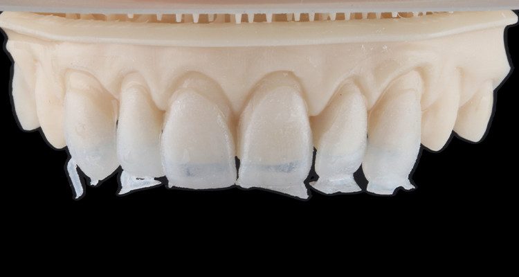 6 | Facetas sobre o modelo antes de serem finalizadas.