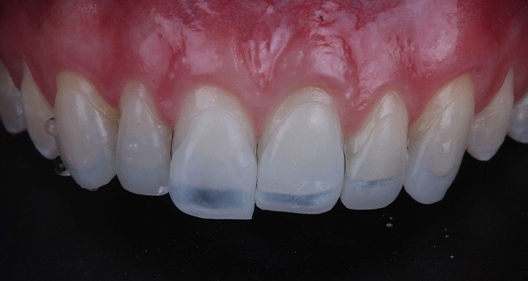 8 | Prova das facetas.