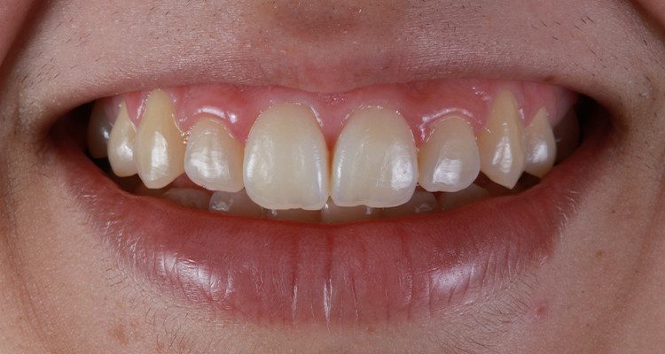 1 | Aspecto inicial.