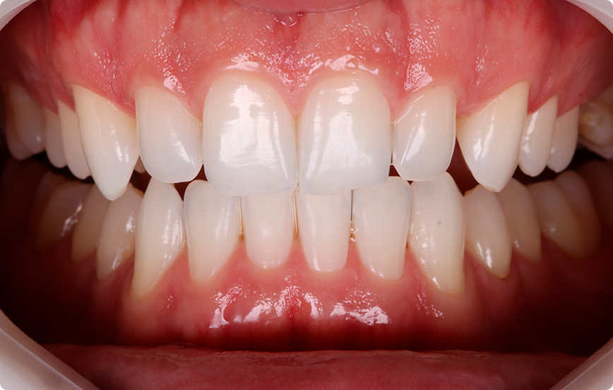 1 | Aspecto inicial.