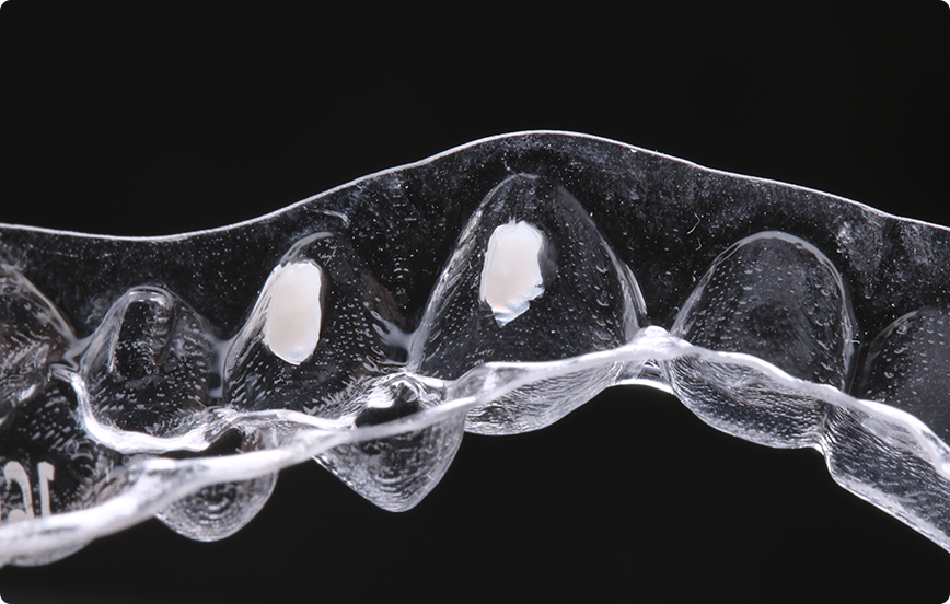 7 | Acomodação da resina Vittra APS Unique no template.