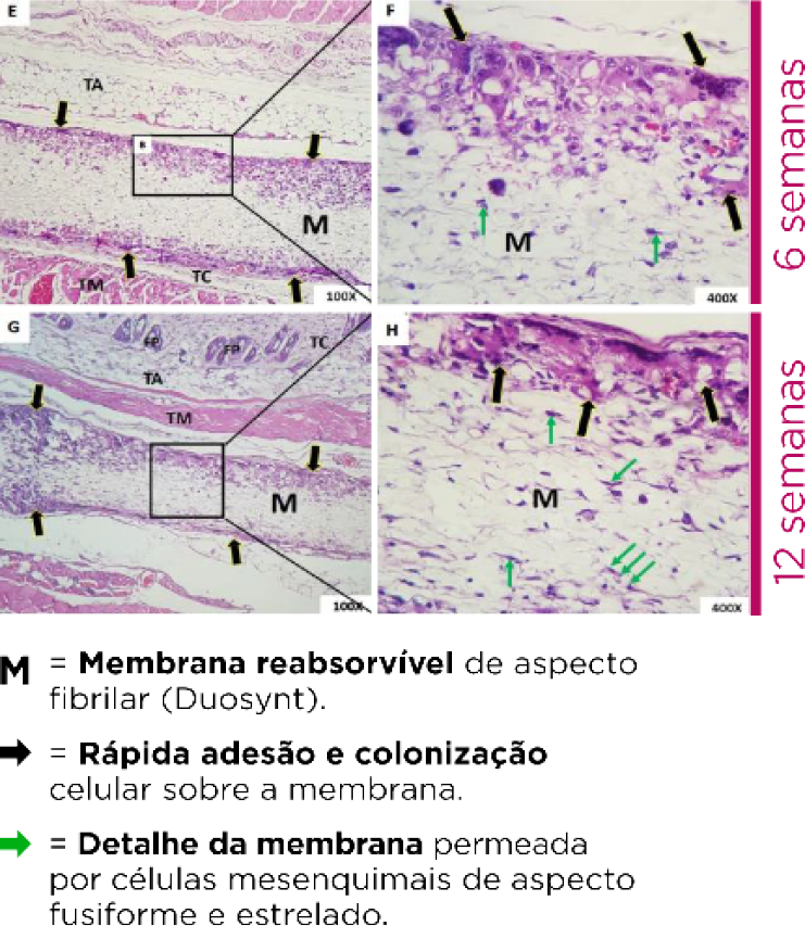 Camadas da membrana sintética Duosynt FGM