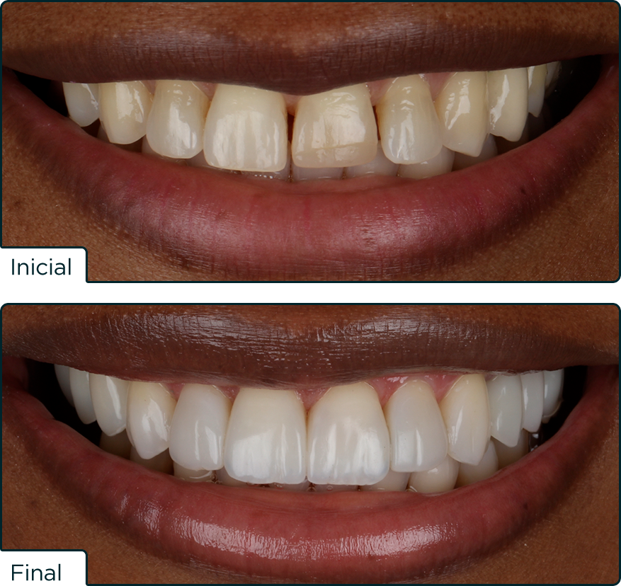 Caso Elora25 Carolina - Concurso Elóra