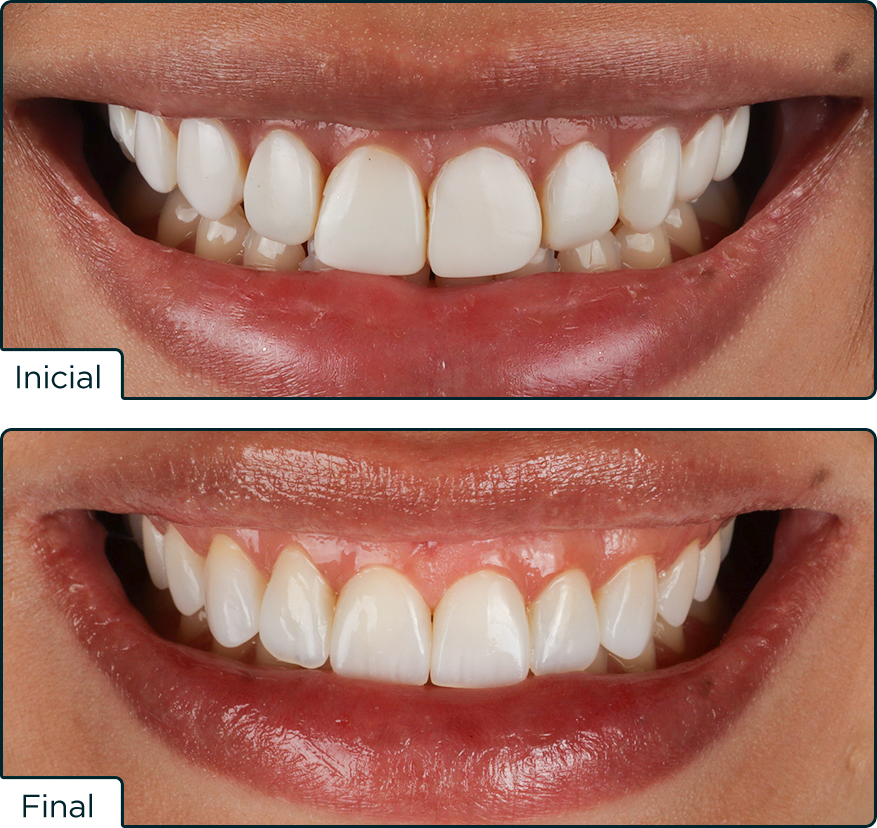 Caso Elora25 Igor - Concurso Elóra