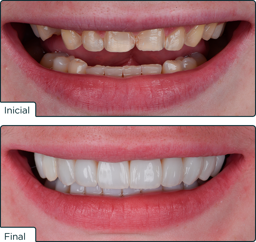 Caso Elora25 Marcelo - Concurso Elóra