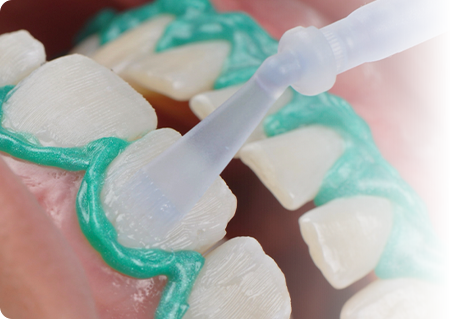 clareamento associado paciente - Pacientes