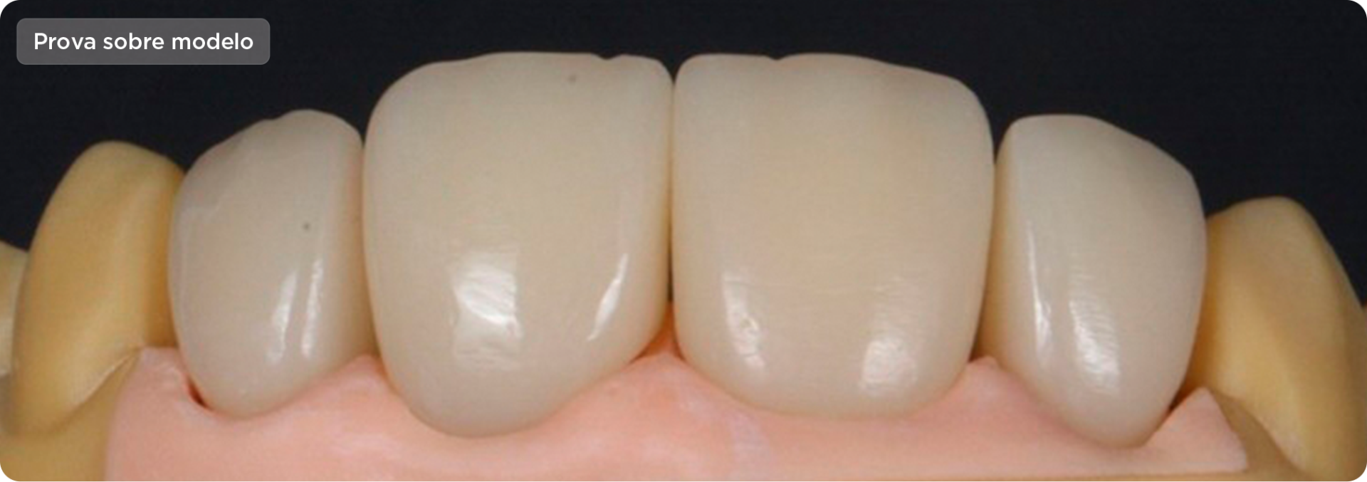 img caso voxel temp 1 - Voxelprint Temp