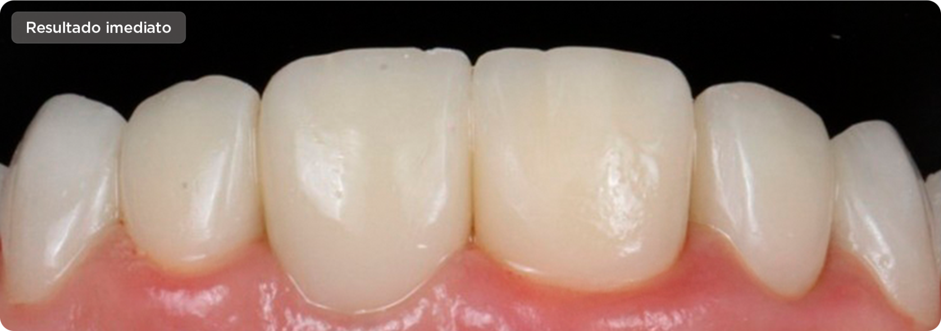 img caso voxel temp 2 - Voxelprint Temp