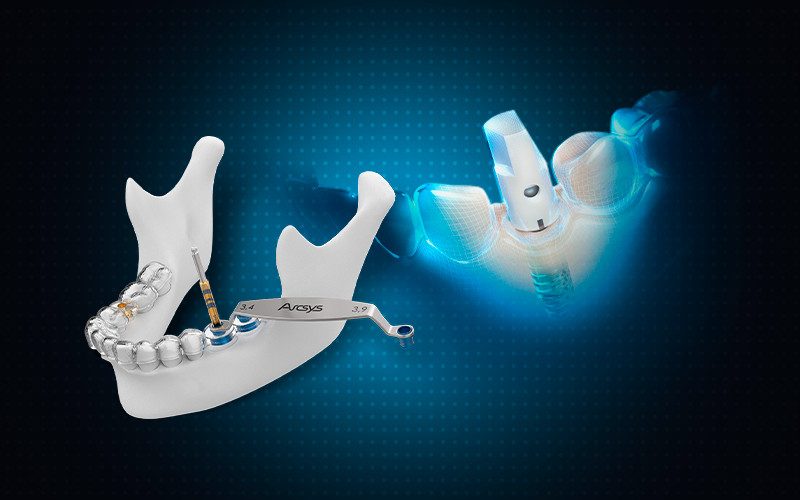 capa linha do tempo arcsys 2016 5 - Sistema de Implantes Arcsys