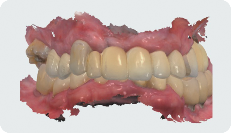 caso fiber pro 2 - Fiber Pro caso fiber pro 2 - Fiber Pro