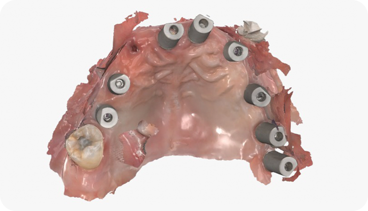 caso fiber pro 3 2 - Fiber Pro caso fiber pro 3 2 - Fiber Pro