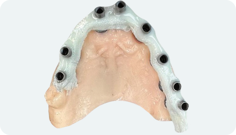 caso fiber pro 5 1 - Fiber Pro caso fiber pro 5 1 - Fiber Pro