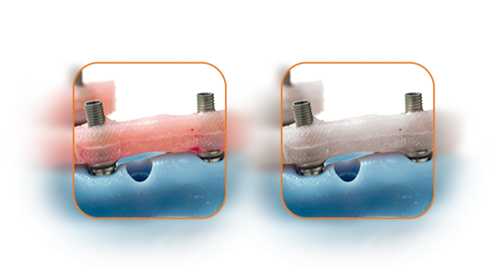 cores proteses fiber pro - Fiber Pro