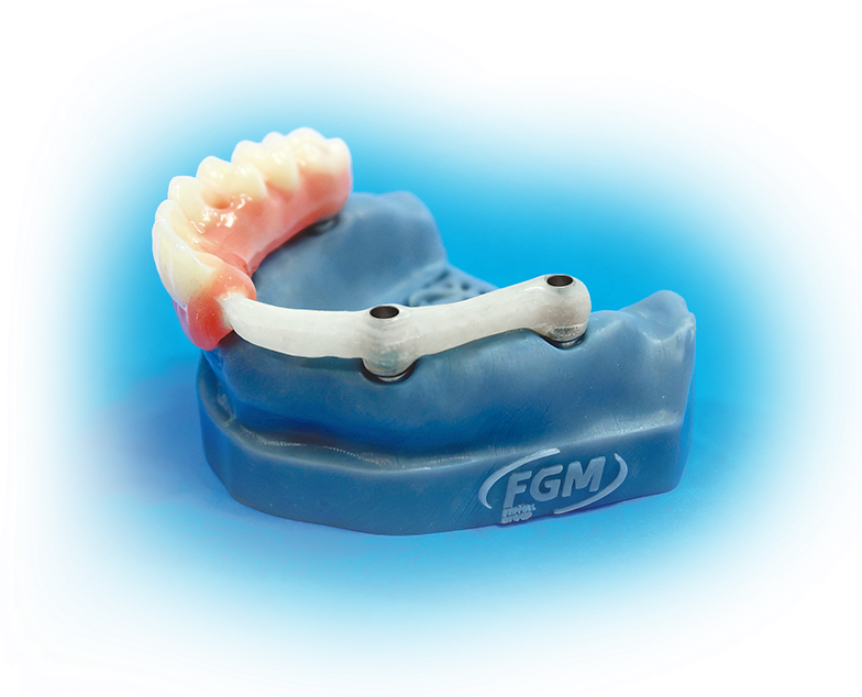 protese sob implante fiber pro - Fiber Pro