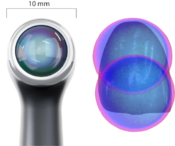 Figura 10: Ponta ativa do QUAZAR de aproximadamente 10 mm de diâmetro, se posicionando entre as maiores do mercado.