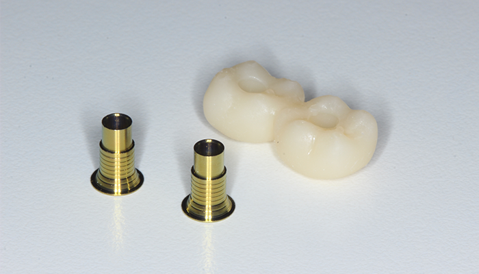 Caso 35 16 - Carga imediata com próteses provisórias confeccionadas pelo fluxo digital 16 | Coroas 46 e 47 impressas em resina Voxelprint TEMP A2 e links para mini pilares Aikkon inteiros.