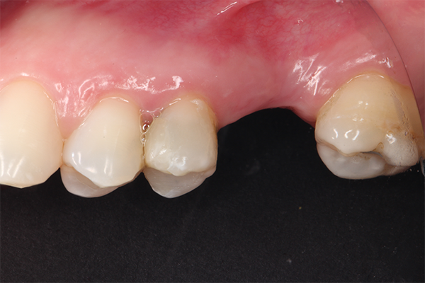 1 | Condição clínica inicial. 