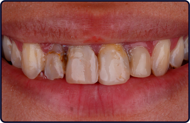 casos clinicos lp fgmnews 26 1 antes - FGM News 2026