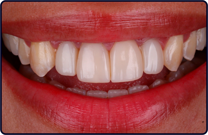 casos clinicos lp fgmnews 26 1 depois - FGM News 2026