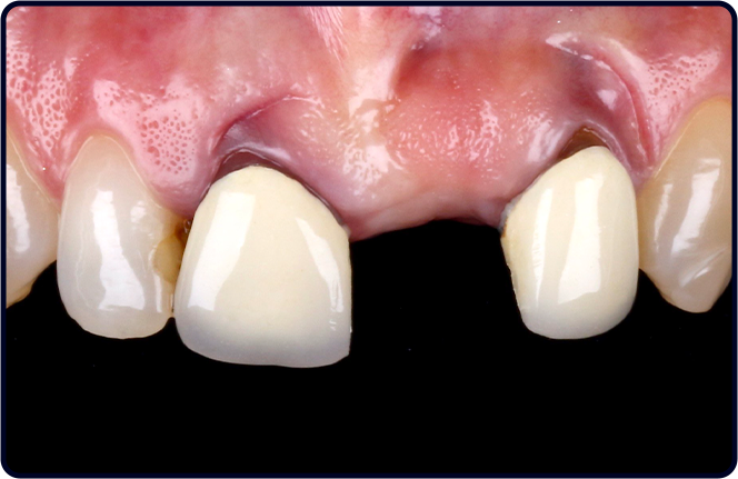 casos clinicos lp fgmnews 26 2 antes 1 - FGM News 2026