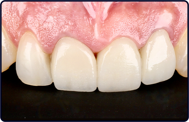 casos clinicos lp fgmnews 26 2 antes - FGM News 2026