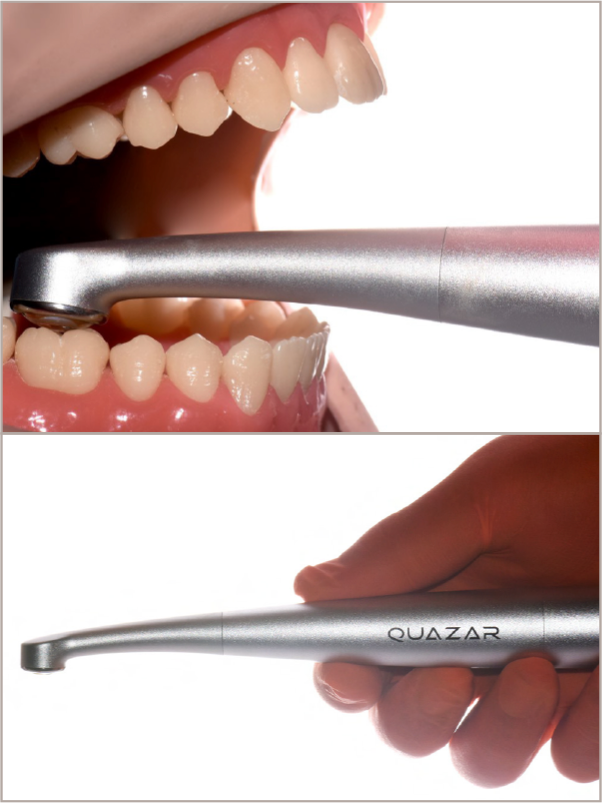 Figura 6: Facilidade de empunhadura do QUAZAR. Notase o design ergonômico, que facilita acesso em regiões posteriores independente da abertura de boca do paciente.
