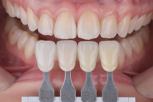 8 e 9 | Aspecto final, seleção de cor.