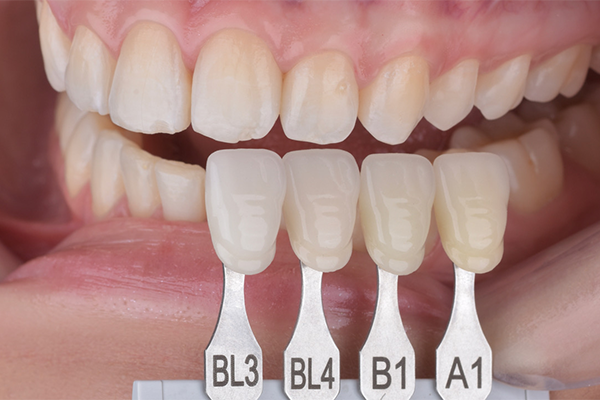 8 e 9 | Aspecto final, seleção de cor.