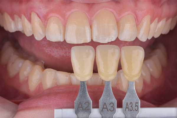 3 e 4 | Aspecto inicial, seleção de cor.