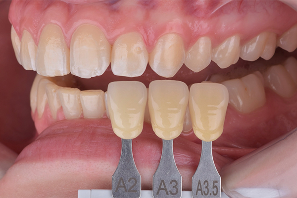 3 e 4 | Aspecto inicial, seleção de cor.