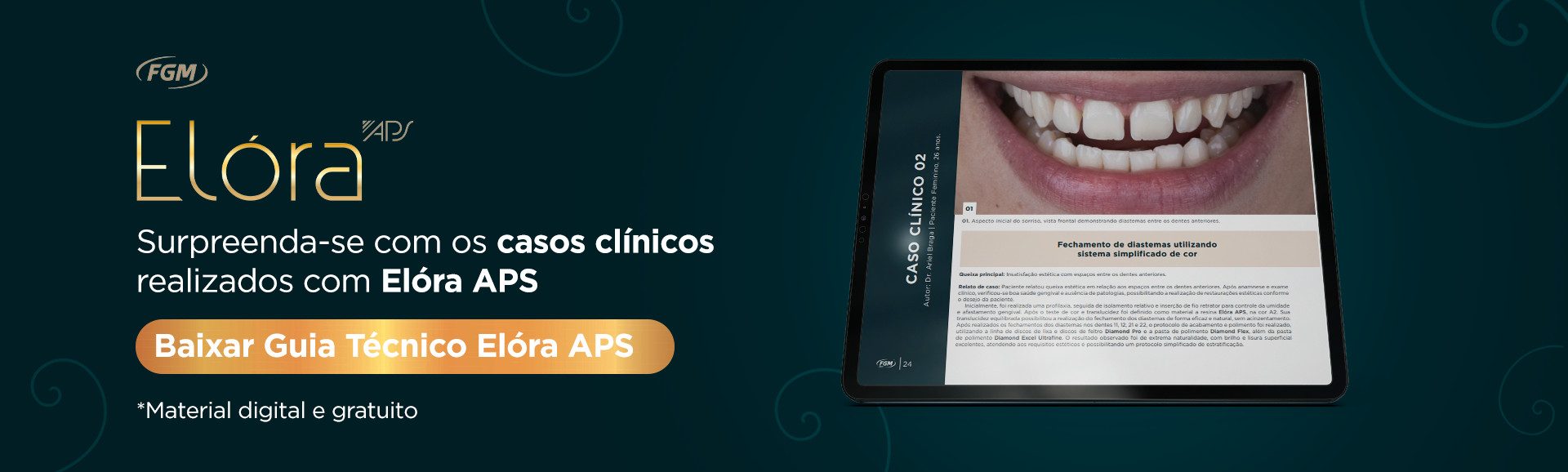 faixa blog Elora APS - Elóra APS: A ciência por trás da composição que eleva a performance dos compósitos restauradores