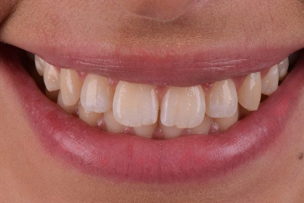26 Caso 3 1 - Promoção Caixa Premiada Whiteness