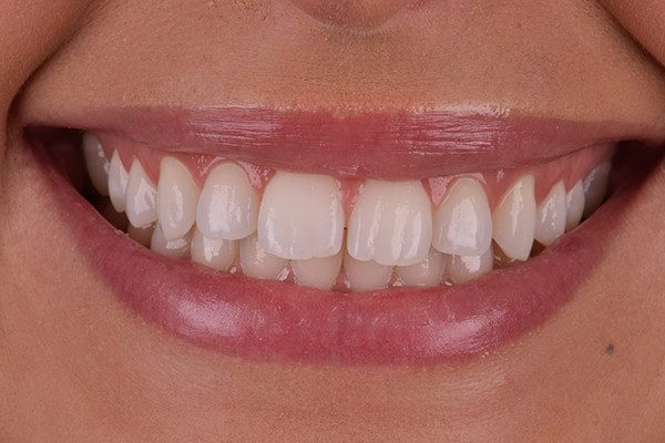 26 Caso 3 7 - Promoção Caixa Premiada Whiteness