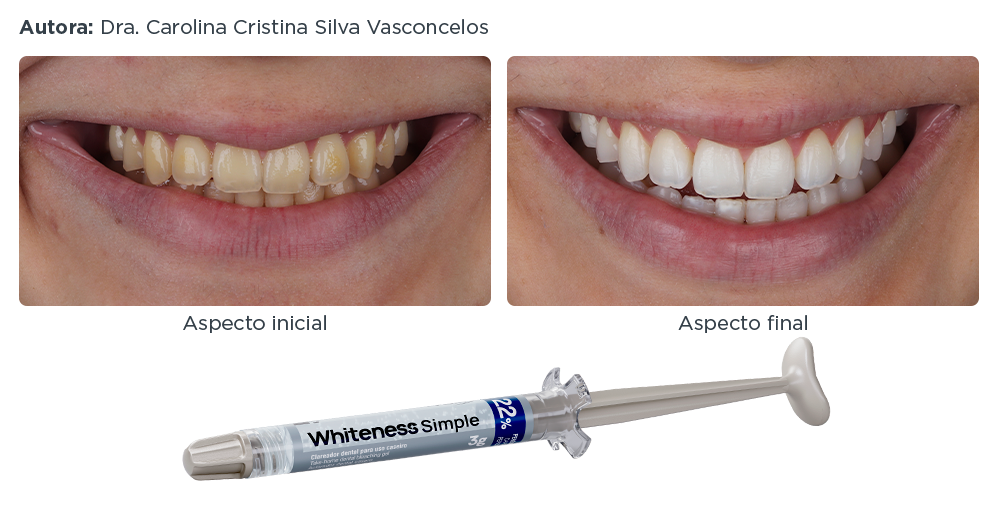 caso-clinico-lp-3-whiteness-simple