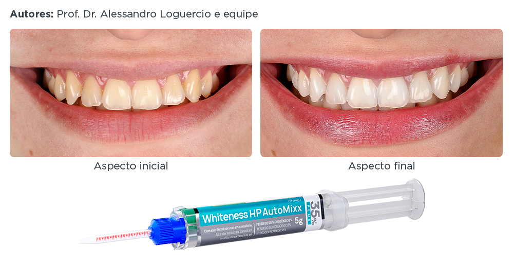 caso-clinico-lp-4-automixx35