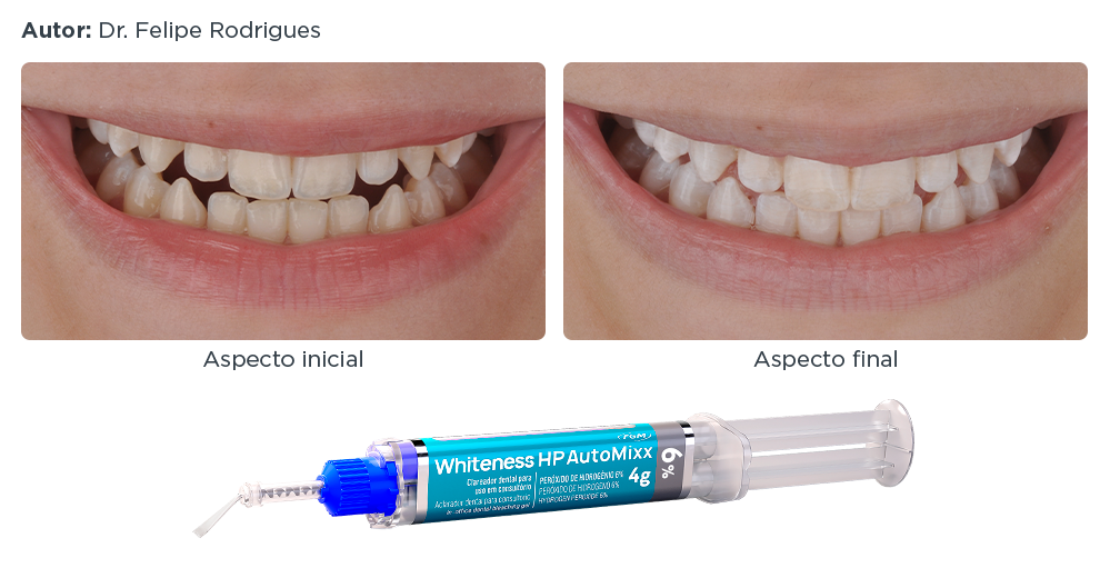 caso-clinico-lp-5-automixx6