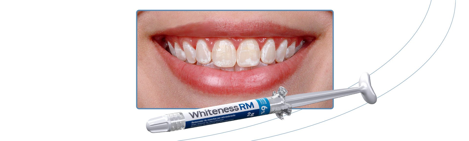 04_Capa-Transformacao-conservadora-do-sorriso-com-clareamento-dental-e-microabrasao