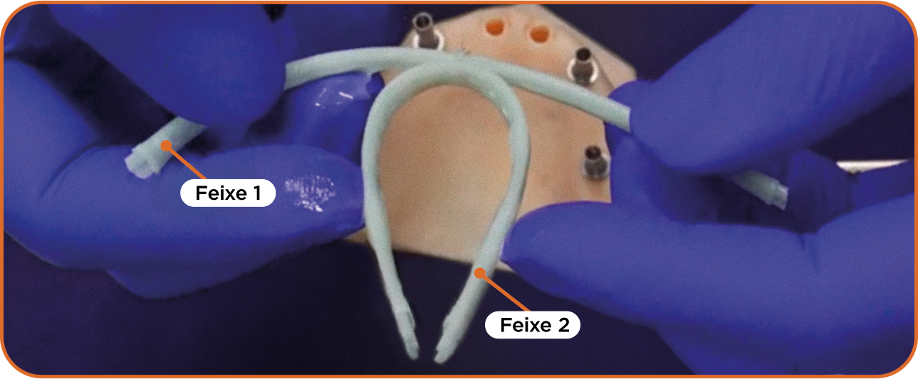 elemento fiber posicionamento - Fiber Pro