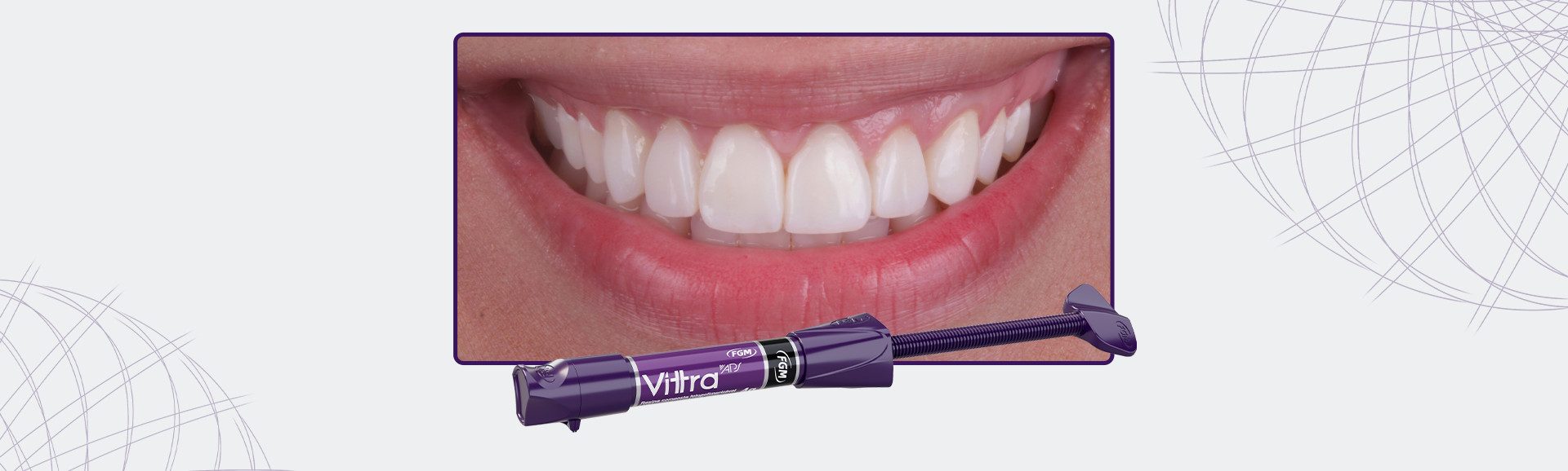 08_Capa-Reabilitação-Oral-Estética-Com-Fechamento-De-Diastemas