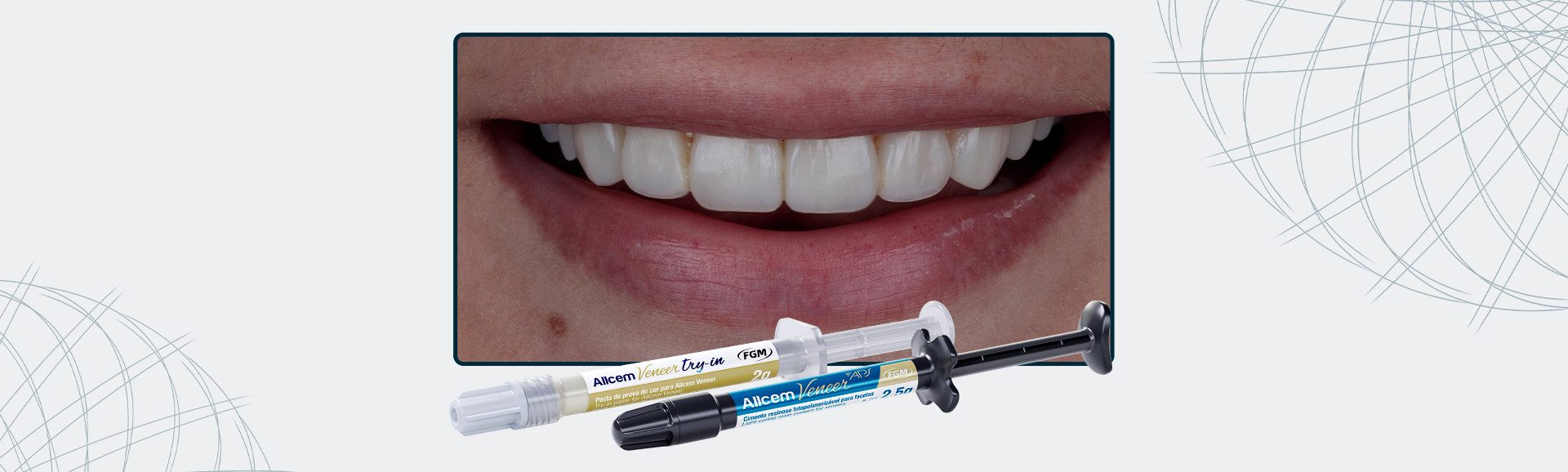 17 Capa Substituicao De Facetas Em Resina Composta Associada A Otimizacao Do Substrato Por Meio De Clareamento Dentario - Substituição de facetas em resina composta associada à otimização do substrato por meio de clareamento dental 17_Capa-Substituição-De-Facetas-Em-Resina-Composta-Associada-À-Otimização-Do-Substrato-Por-Meio-De-Clareamento-Dentário